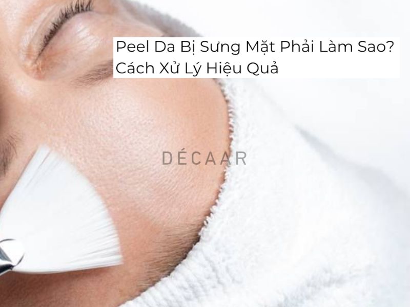 peel da bị sưng mặt phải làm sao